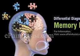Image result for What's Cause Loss Word Memory