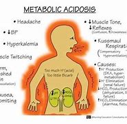 Image result for acidozis