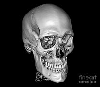 Image result for Skull 3D Scan