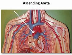 Image result for Ascending Aorta