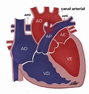 Image result for arterioso