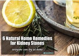Image result for Kidney Stones Home Remedies
