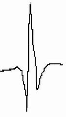 Image result for Nexus 4 Biotracer EMG Waveform