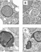 Image result for Fusee Autophages