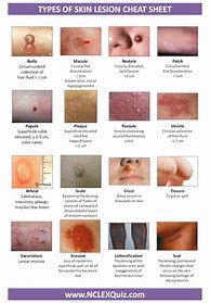 Image result for Skin Rash Identification Chart