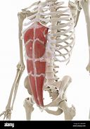 Image result for Musculo Recto Abdominal