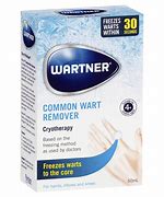 Image result for Wart Removal System