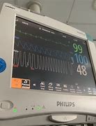 Image result for Pulse Monitor Hospital