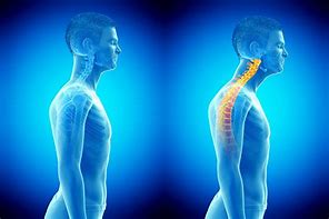Image result for Body Alignment Posture
