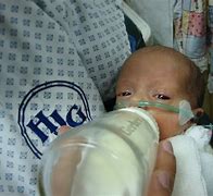 Image result for Milk for Premature Babies