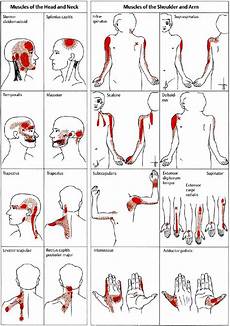 Pin On Myofascial Trigger Point Amp Healing Therapy