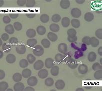 Image result for hematozoario