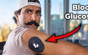 Image result for CGM Glucose Monitor