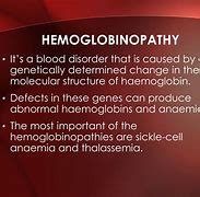 Image result for Hemoglobin C Trait