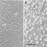 Image result for Umbilical Cord Mesenchymal Stem Cells