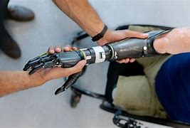 Image result for People with Robot Arms