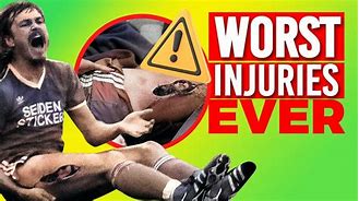Image result for Worst Football Injuries