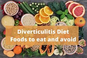 Image result for Diverticulitis What Can I Eat