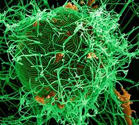 Image result for ebola pictures
