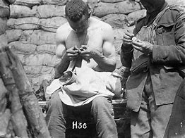 Image result for Body Lice WW1