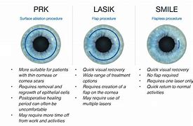 Image result for PRK Eye Surgery