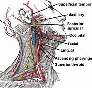 Image result for Arteries in Your Neck