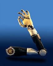 Image result for Prosthetic Arm Concept