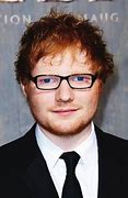 Image result for Why Is Ed Sheeran Eyes