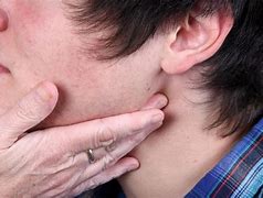 Image result for Lump On Jaw