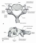 Image result for Cervical Vertebrae Labelled