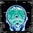 Image result for Brain Scan Stock Image