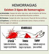 Image result for Clasificacion Hemorragia