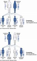 Image result for Homozygous Condition