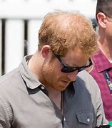 Image result for Prince Harry Losing Hair