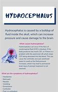 Image result for Hydrocephalus Brain Injury