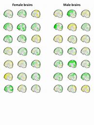 Image result for Men vs Women Brain