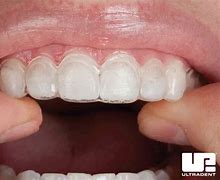 Image result for SOF Tissue Cheek X Tray