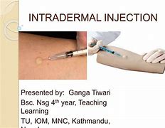 Image result for Intradermal Injection Wheal
