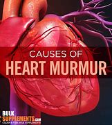 Image result for Heart Murmur Surgery