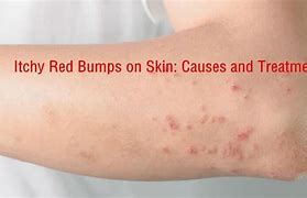 Image result for Contagious Bumps On Skin
