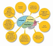 Image result for Basic Diagram About Trauma and the Brain
