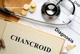 Image result for Chancroid Antibiotics