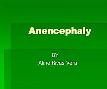 Image result for Anencephaly PPT