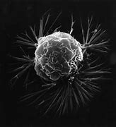 Image result for Cancer Microscope