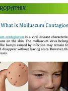 Image result for Molluscum Contagiosum Treatment Phase