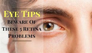 Image result for Eye Cone Problems