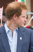 Image result for Prince Harry Bald Spot