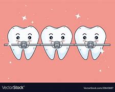 Image result for Cartoon Treatment Cards Orthodontist
