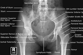 Image result for Pelvic Bone Identification