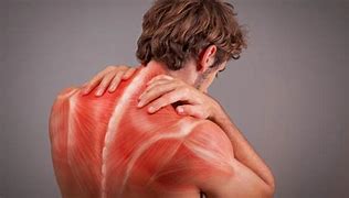 Image result for Contractura Muscular